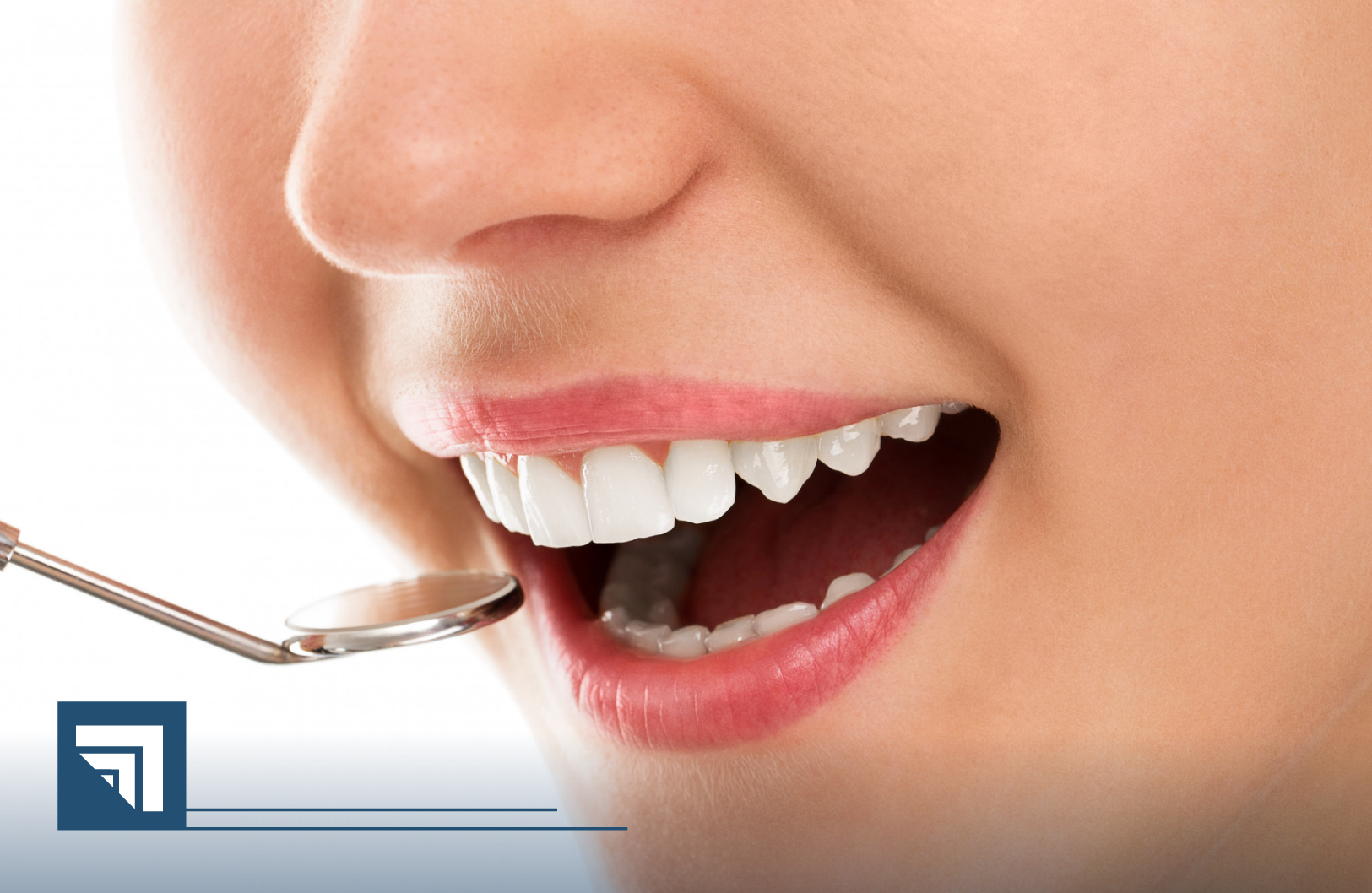 UCQ CMS PAGINA periodoncia_beneficios-1